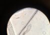 Nużeniec demodex